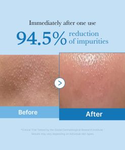 Zero Pore Blackhead Deep Cleansing Oil