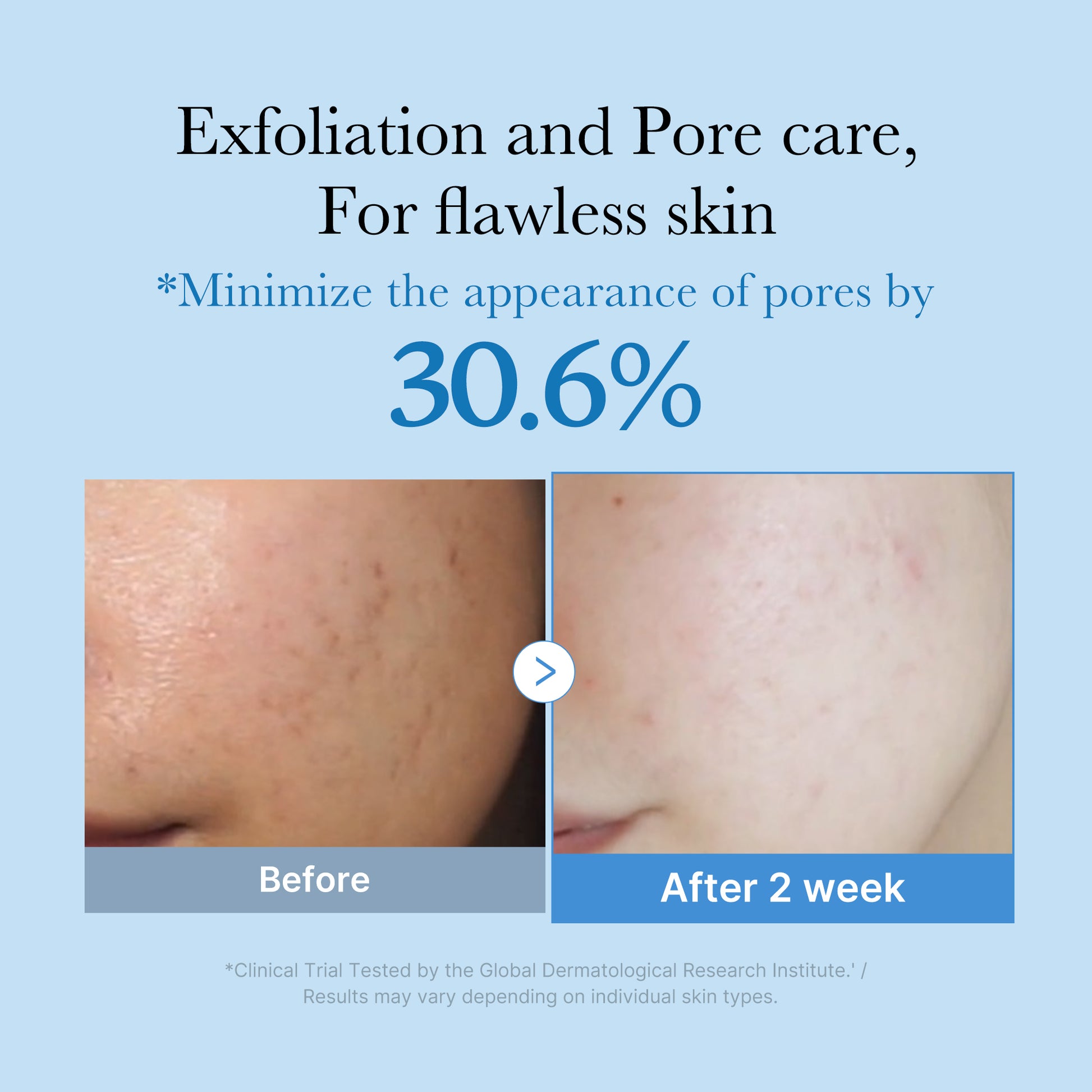 Zero Pore Toner - Image 2