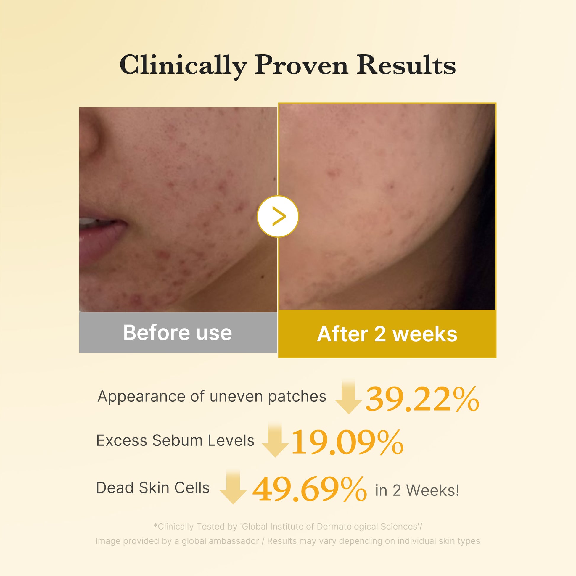 Kojic Acid Tumeric Toner Pad - Image 4