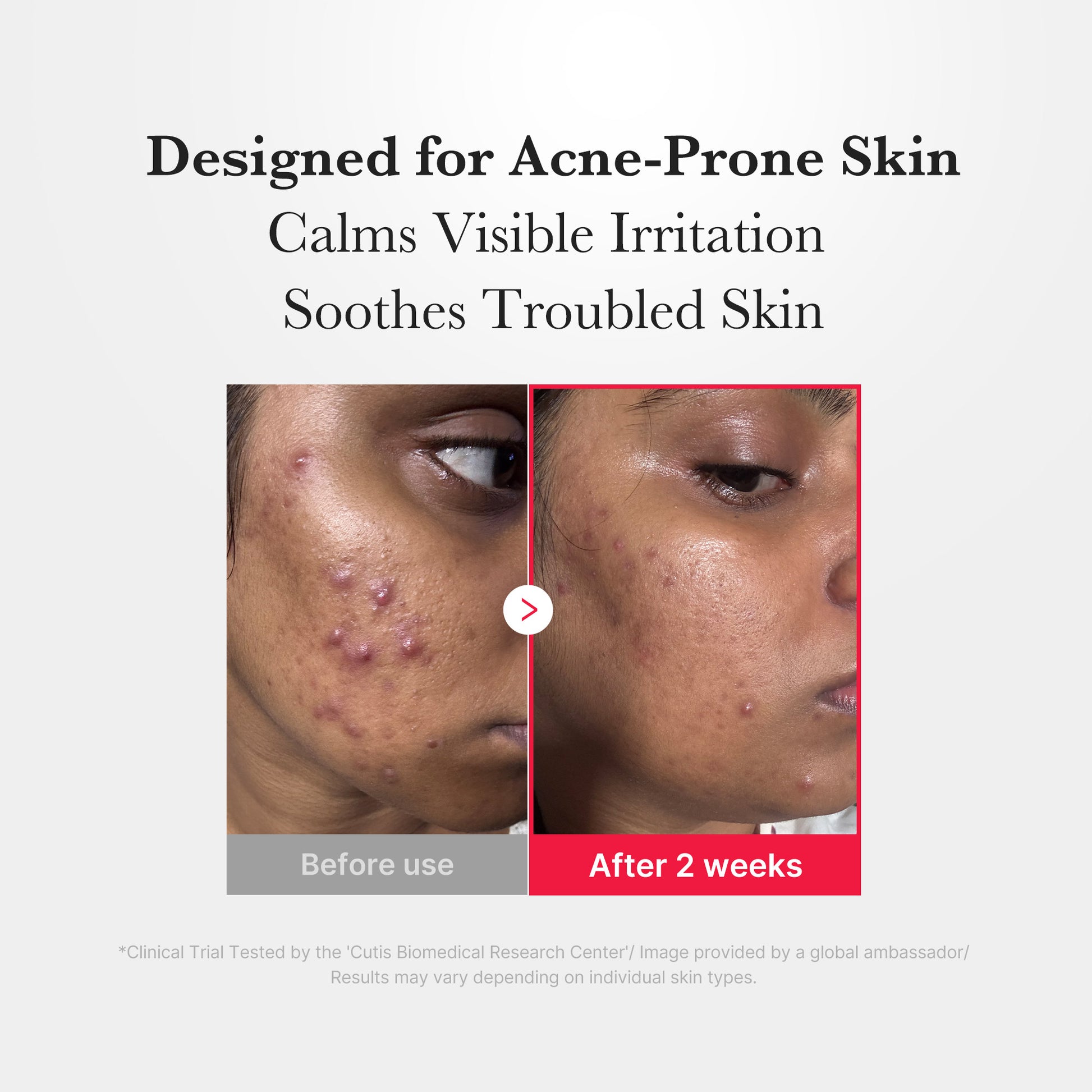 Hypochlorous Acid Power Soothing Spray - Image 5