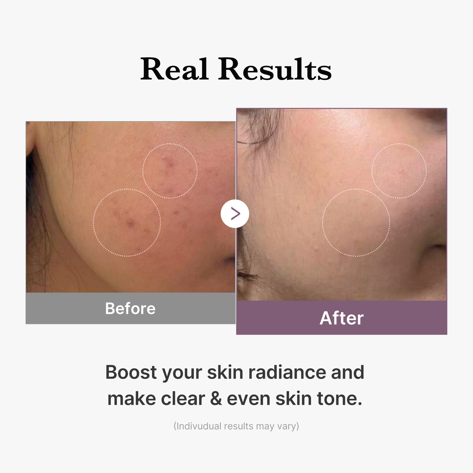 AGE-R Glutathione Glow Milk Toner - Image 5