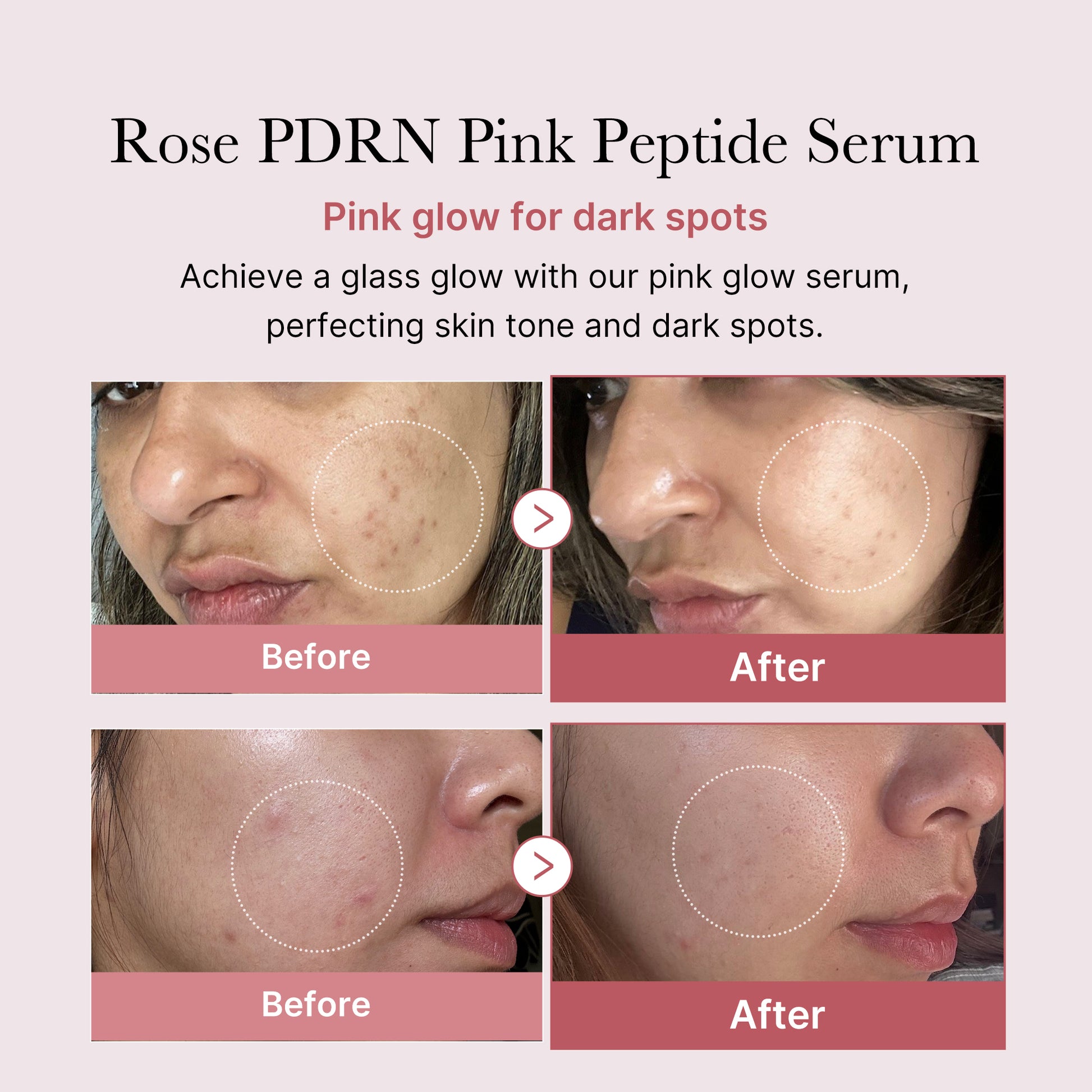 PDRN Pink Peptide Serum - Image 4