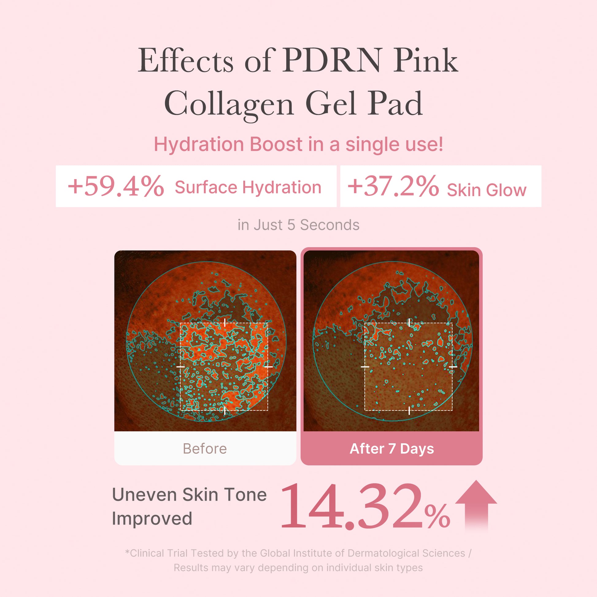 PDRN Pink Collagen Gel Toner Pad - Image 5