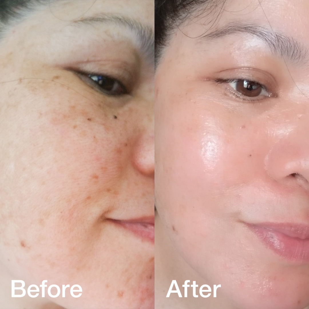 Collagen Booster Set - Image 2