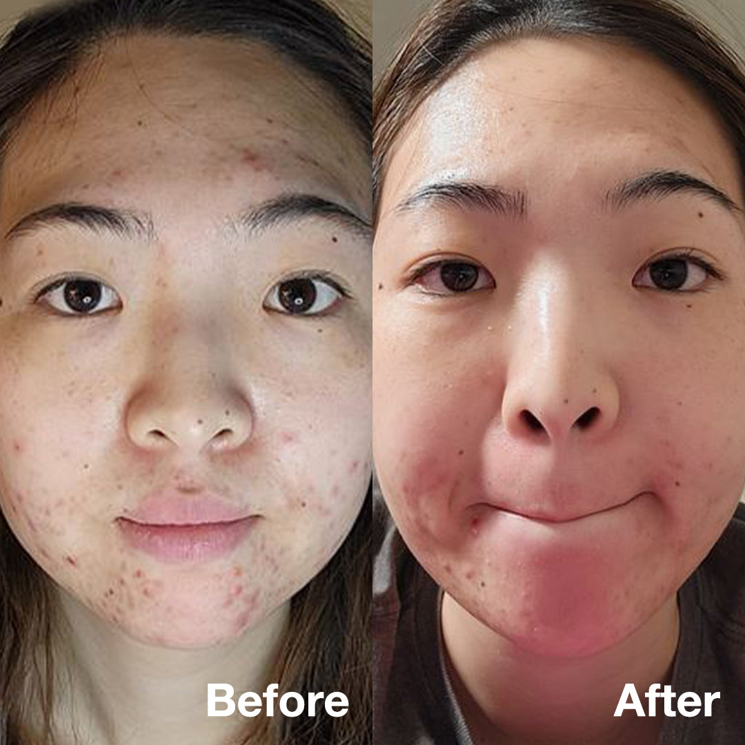 Super Cica Ampoule - Image 6