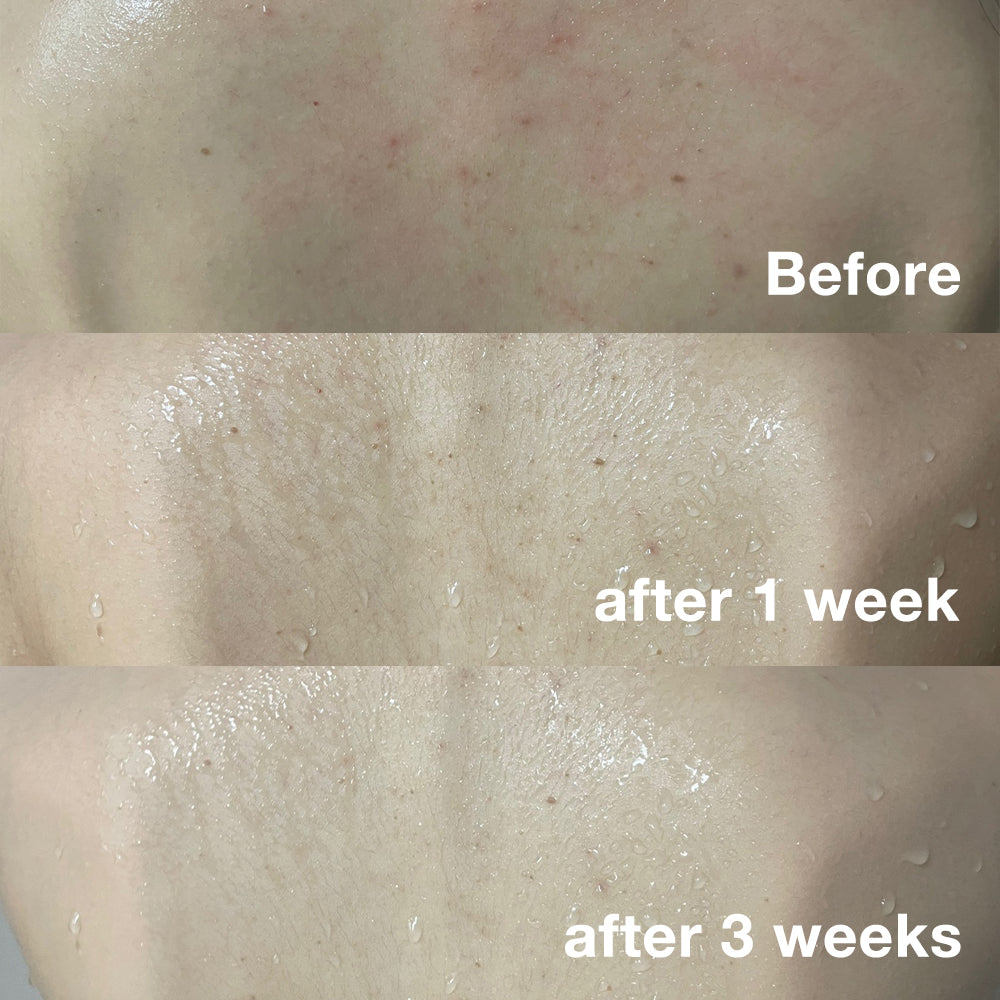 Red Body Wash - Image 2