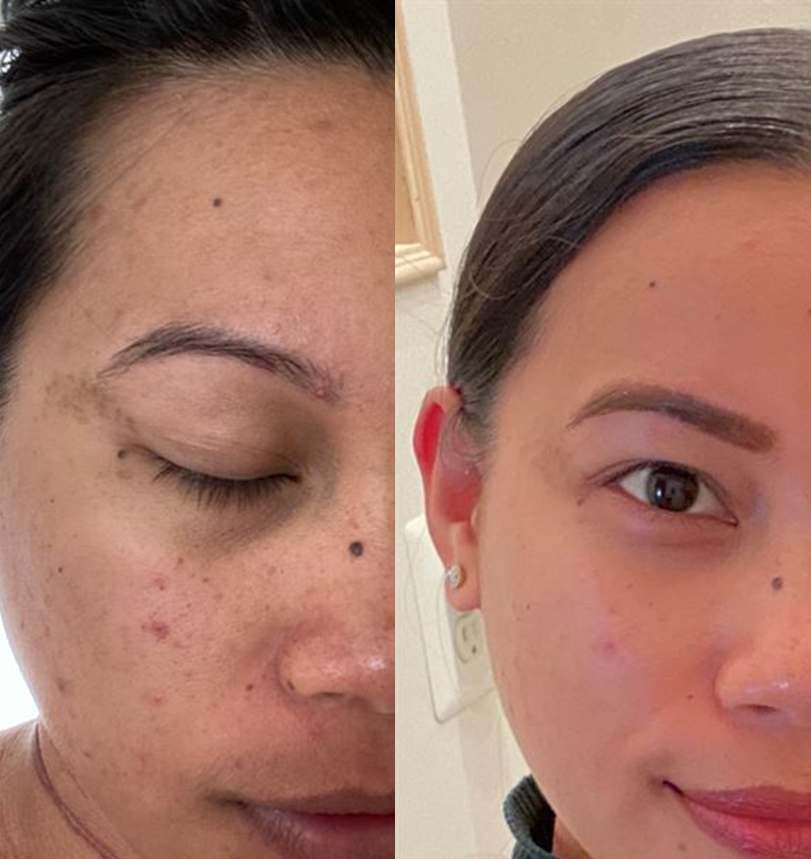 Deep Vita C Ampoule - Image 2